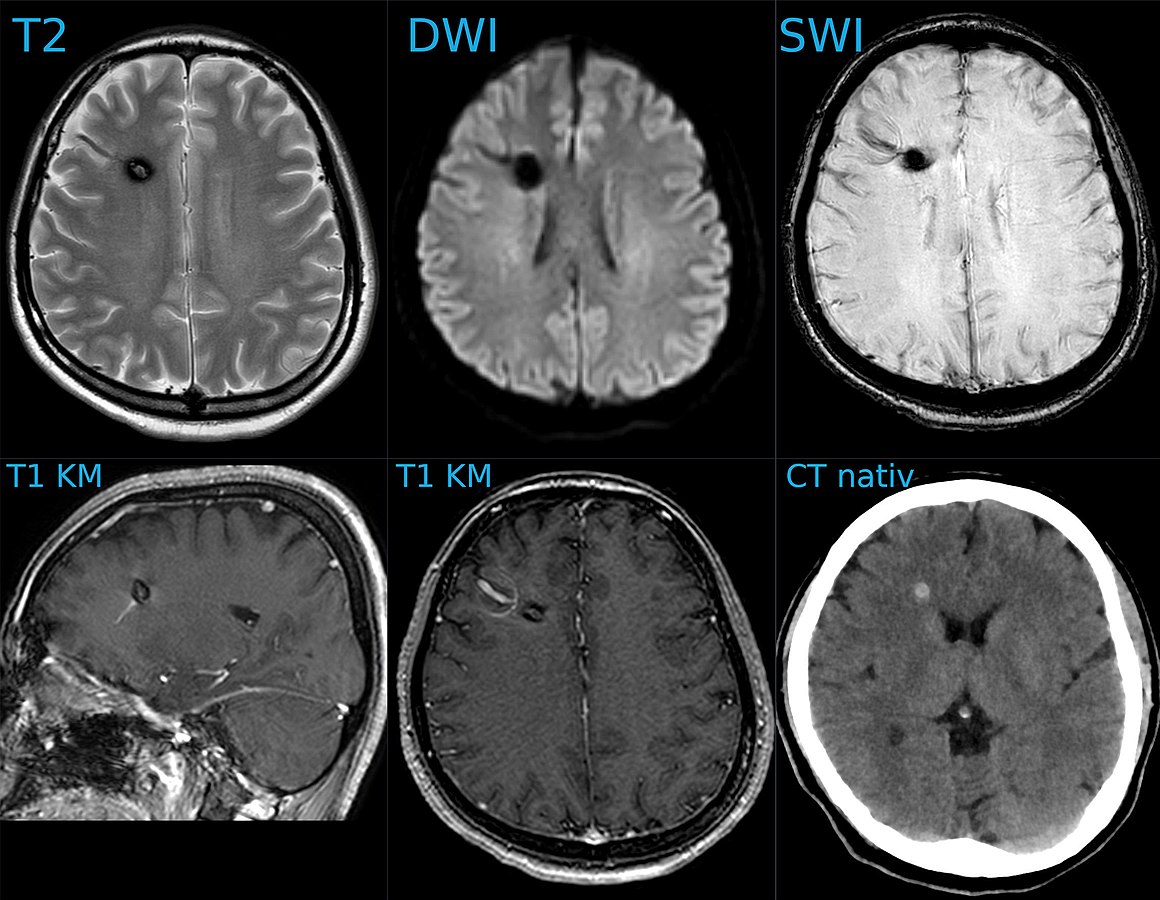 example showing how different scan types produce different contrasts