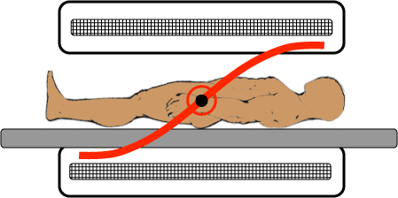 Diagram showing how the magnetic field of an MRI machine varies across a patient