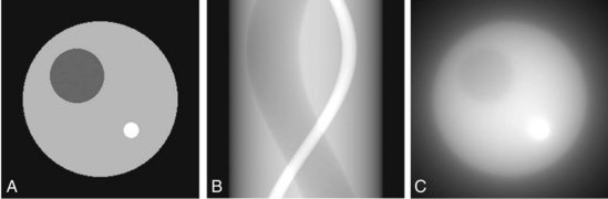 Computer simulation showing how backprojection works to produce a sinogram and reconstruct the image