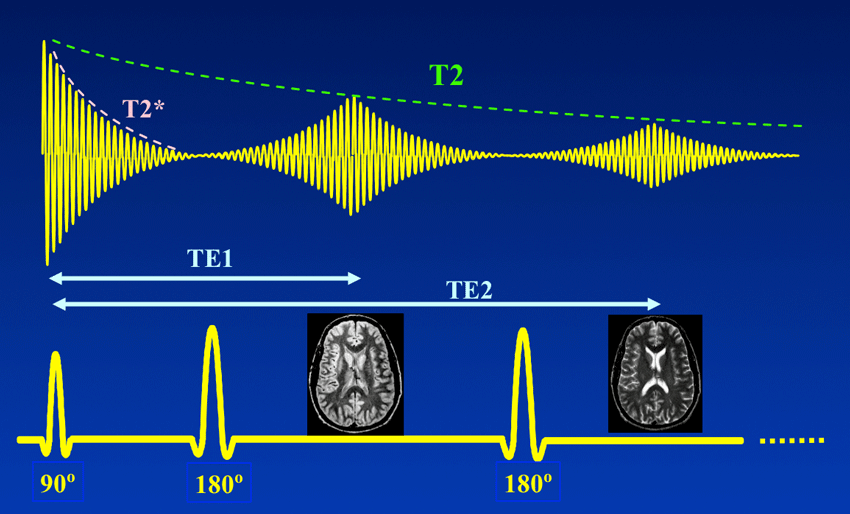 graph showing how quickly T2* delays, but with a timed second 180 degree pulse the signal will refocus for a short time